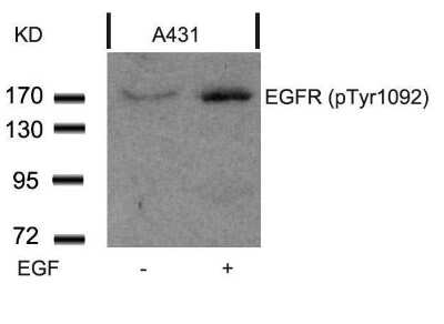 Western Blot: EGFR [p Tyr1092] Antibody [NB100-81894]